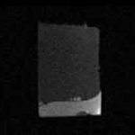 磁共振t1t2怎么区分